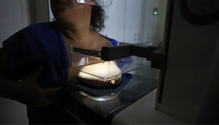  Vigitel: 92% das brasileiras entre 50 e 69 anos fizeram mamografia 
